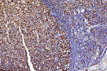 FEN1 Antibody (monoclonal, 6F3F2)