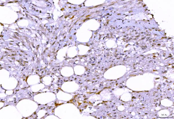SHP1/PTPN6 Mouse Monoclonal Antibody