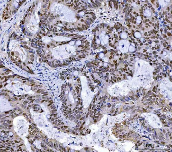 MSH2 Antibody (monoclonal, 6B4F7)