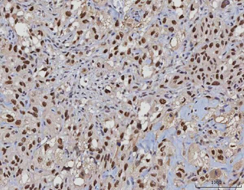MSH2 Antibody (monoclonal, 6B4F7)