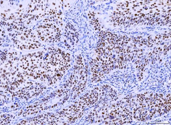 MSH2 Antibody (monoclonal, 6B4F7)