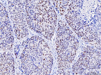 MSH2 Antibody (monoclonal, 6B4F7)