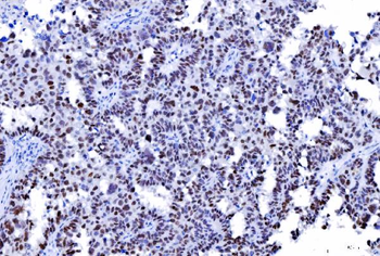 MSH2 Antibody (monoclonal, 6B4F7)