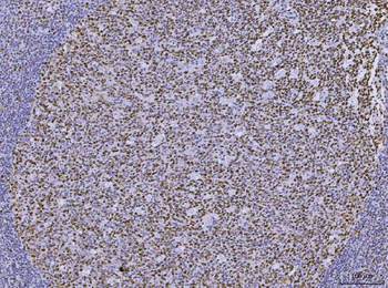 MSH2 Antibody (monoclonal, 6B4F7)
