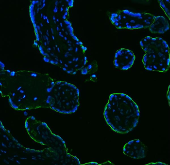 ALPP Antibody (monoclonal, 6C7G3)