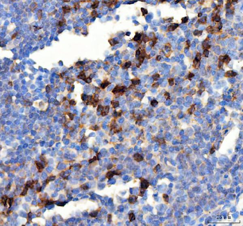PD-1/PDCD1/PD Rabbit Polyclonal Antibody