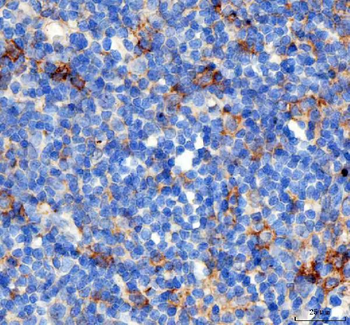 PD-1/PDCD1/PD Rabbit Polyclonal Antibody