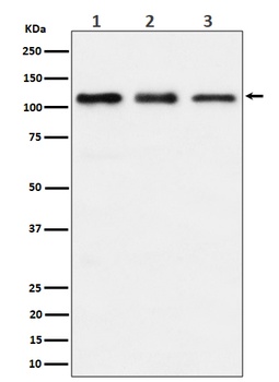 TAOK1 Rabbit Monoclonal Antibody