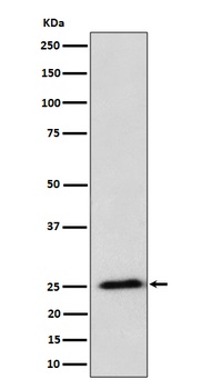 RPL10A Rabbit Monoclonal Antibody