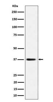 MRPS31 Rabbit Monoclonal Antibody