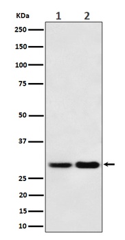 MTAP Rabbit Monoclonal Antibody