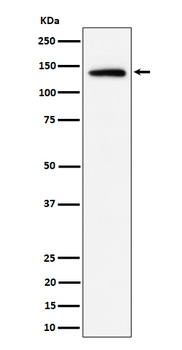 Importin 9/RANBP9 Rabbit Monoclonal Antibody