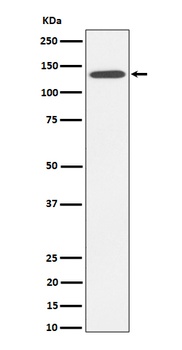 R Cadherin Rabbit Monoclonal Antibody