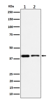 SLP2 Rabbit Monoclonal Antibody