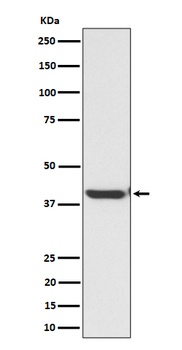 ENDOGL1 / ENGL Rabbit Monoclonal Antibody