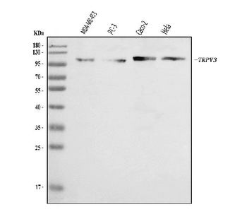 TRPV3 Rabbit Polyclonal Antibody