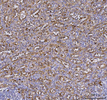 TLR9 Rabbit Polyclonal Antibody