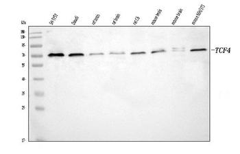 TCF4 Rabbit Polyclonal Antibody