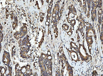 RGS12 Rabbit Polyclonal Antibody