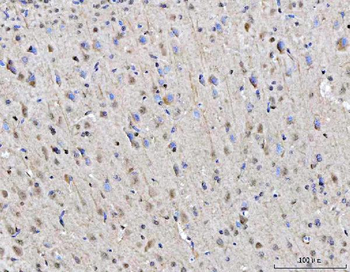 RGS12 Rabbit Polyclonal Antibody