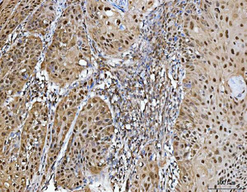PRMT5 Antibody