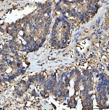 PRMT5 Antibody