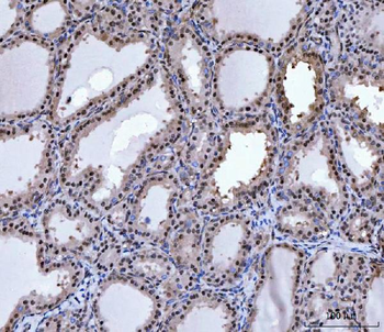 PRMT5 Antibody