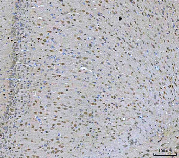 PRMT5 Antibody