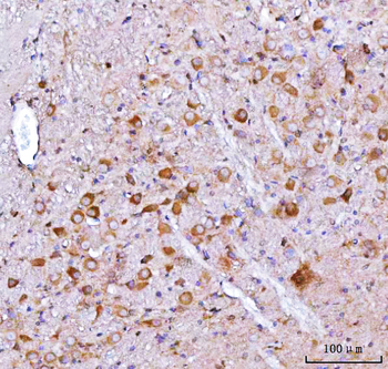 Nms Rabbit Polyclonal Antibody