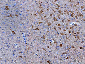 Nms Rabbit Polyclonal Antibody