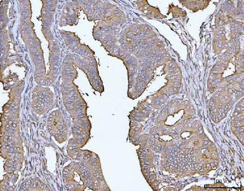 MUC1 Rabbit Polyclonal Antibody