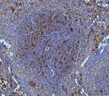 Dkk1 Rabbit Polyclonal Antibody