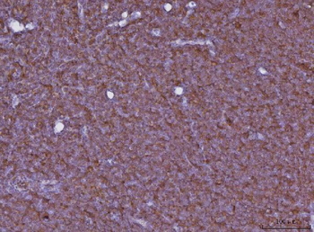 Cxcr3 Antibody