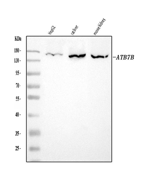 ATP7B Rabbit Polyclonal Antibody