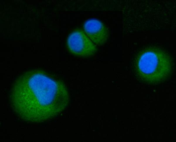 ABP1/AOC1 Rabbit Polyclonal Antibody