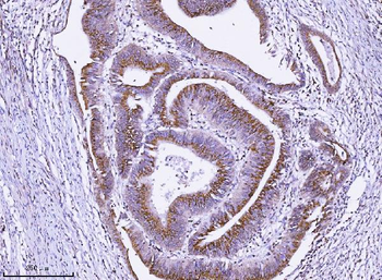 ALDH3A1 Rabbit Polyclonal Antibody