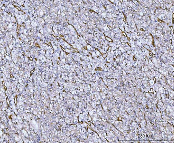 Von Willebrand Factor/VWF Antibody