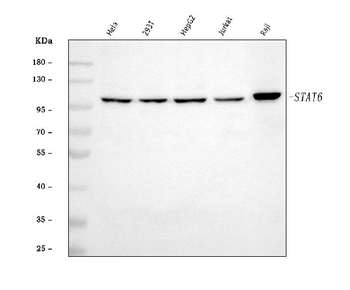 STAT6 Rabbit Polyclonal Antibody