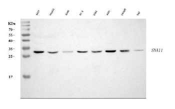 SNAIL/SNAI1 Rabbit Polyclonal Antibody