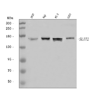 SLIT2 Rabbit Polyclonal Antibody