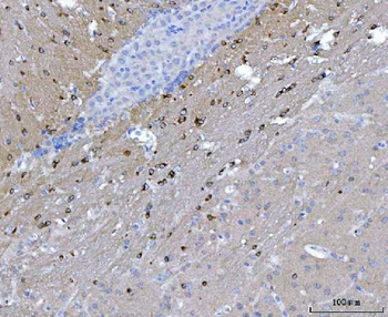 CAPON/NOS1AP Rabbit Polyclonal Antibody