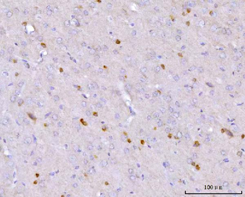 CAPON/NOS1AP Rabbit Polyclonal Antibody