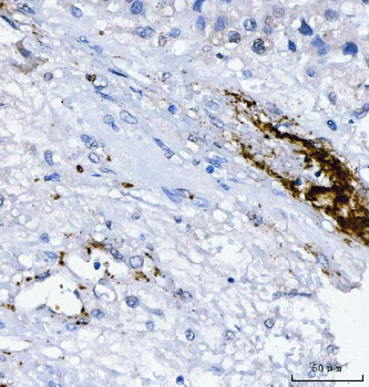 Integrin beta 3/ITGB3 Rabbit Polyclonal Antibody