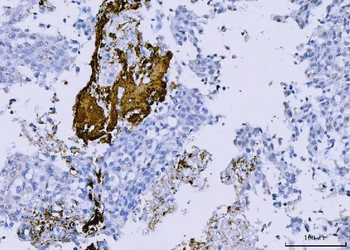 Integrin beta 3/ITGB3 Rabbit Polyclonal Antibody