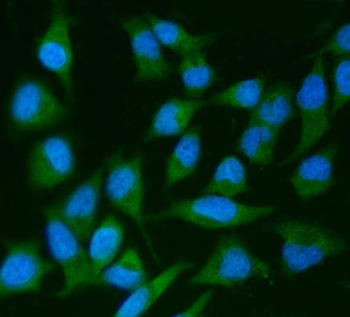 IRS2 Rabbit Polyclonal Antibody