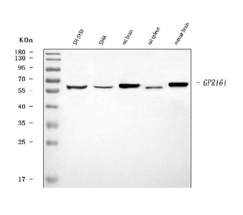 GPR161 Rabbit Polyclonal Antibody