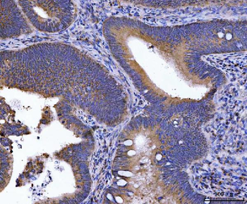 GOLGA3 Rabbit Polyclonal Antibody