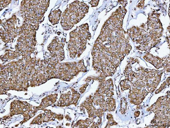 GLUD1/2 Antibody