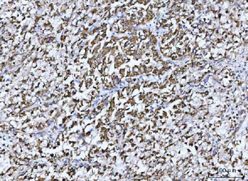 GLUD1/2 Antibody