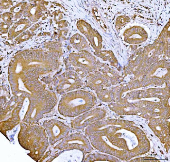 FKBP1A/1B Rabbit Polyclonal Antibody